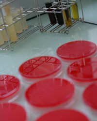 Analyses bactériologiques