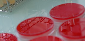 Analyses bactériologiques