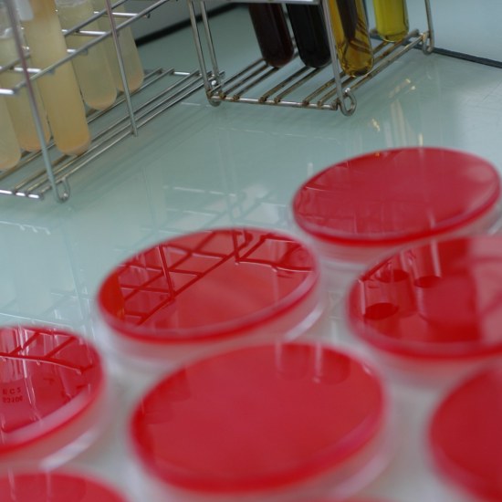 Analyses bactériologiques