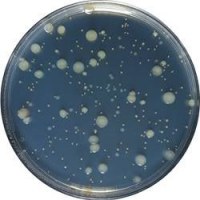 Analyses Bactériologiques Cosmétiques et Détergents