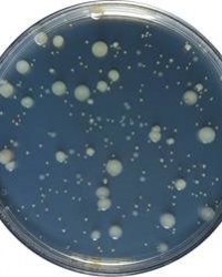 Analyses Bactériologiques Cosmétiques et Détergents