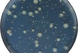 Analyses Bactériologiques Cosmétiques et Détergents